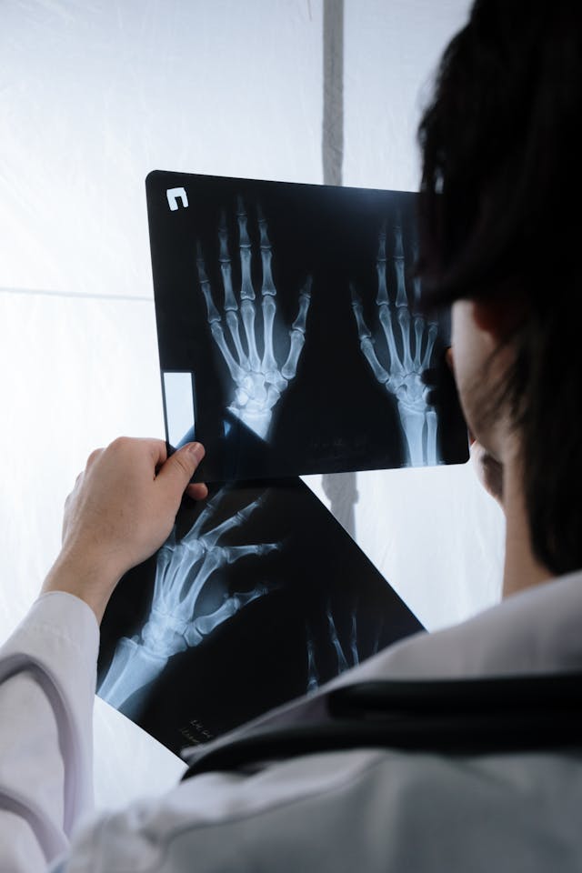 Illinois scoliosis Disability Attorney
